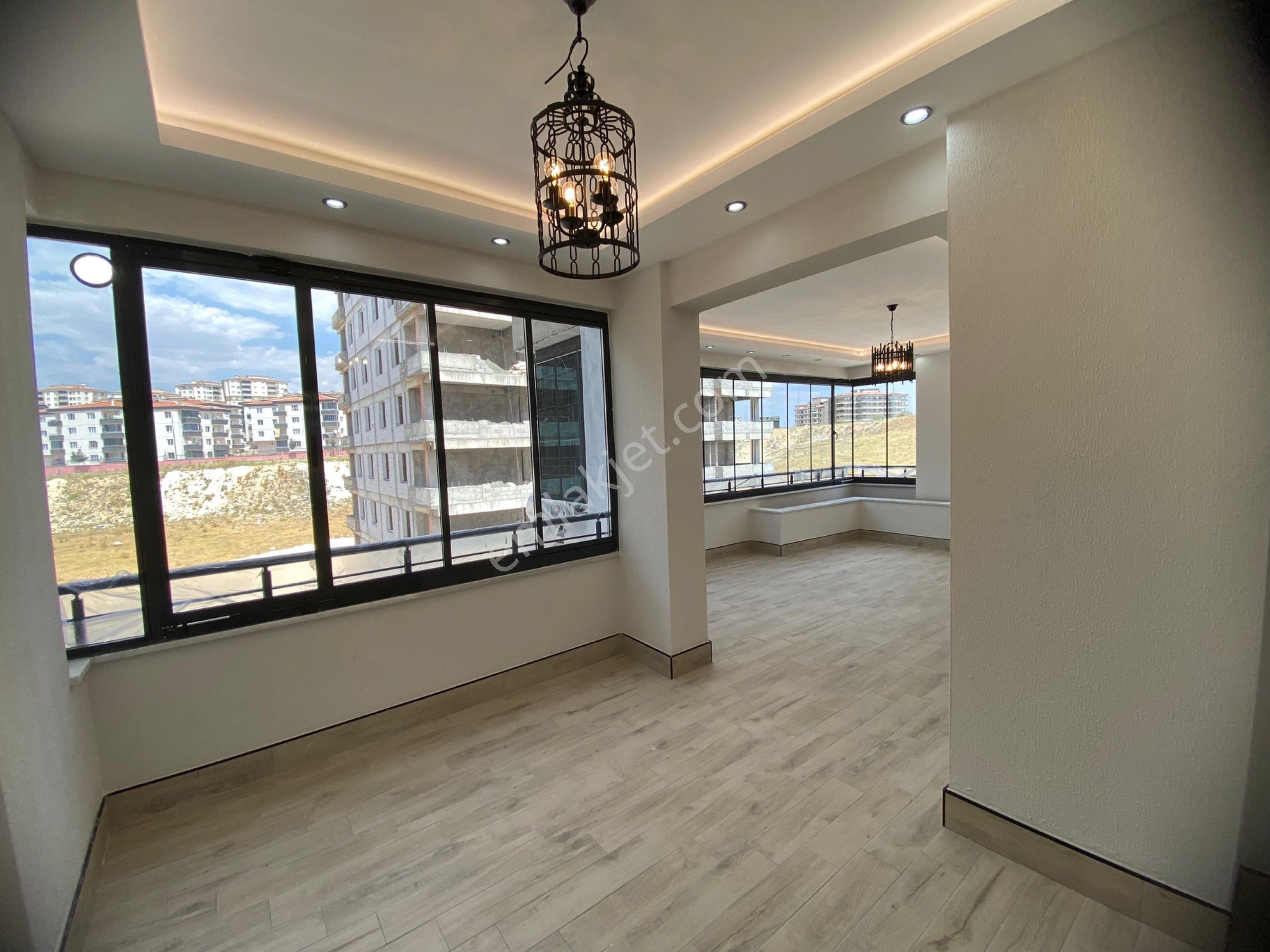 Onkolojide 3.5+1 Resimler Örnek Daireye Aittir Bire Bir Aynısıdır - Görsel 25