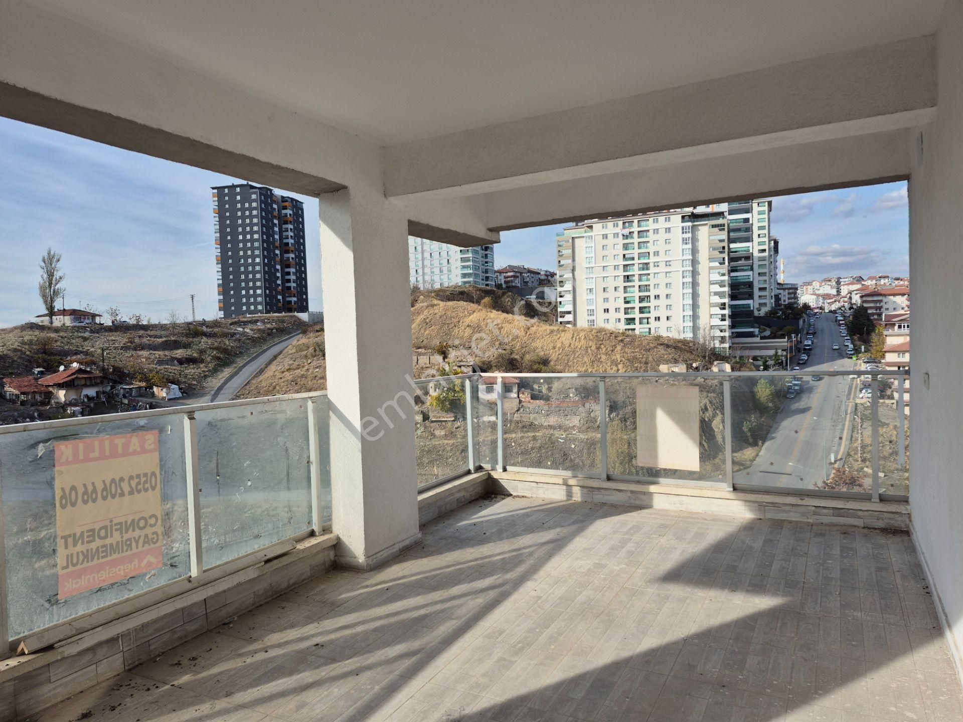 Mamak Türközü Geniş Balkon Ve Manzaralı 140m2 Satılık 3+1 Daire - Görsel 12